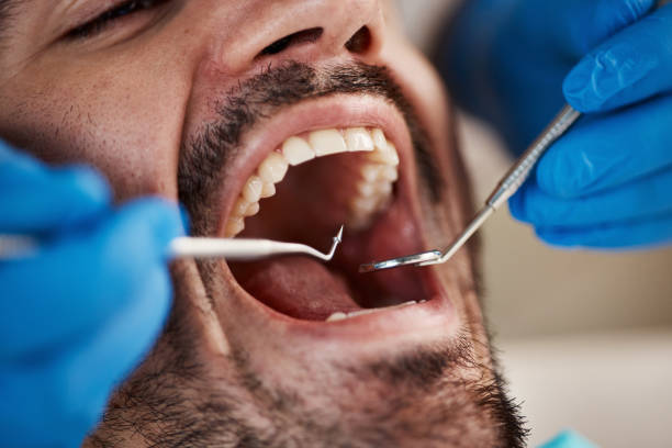Best Emergency Treatment for Dental Infections or Abscesses in Crenshaw, MS